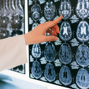 Especialista em casos complexos Experiência em reabilitação neurológica (AVC, Parkinson, Alzheimer, paralisia cerebral e mais), ortopedia, geriatria e pediatria.